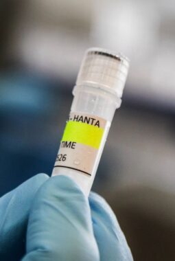 Menkes Budi Gunadi: Hantavirus di Jakarta Terkendali dan Tidak Mudah Menular